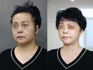 倒三角脸型：独立自主者的人生哲学与职业优势